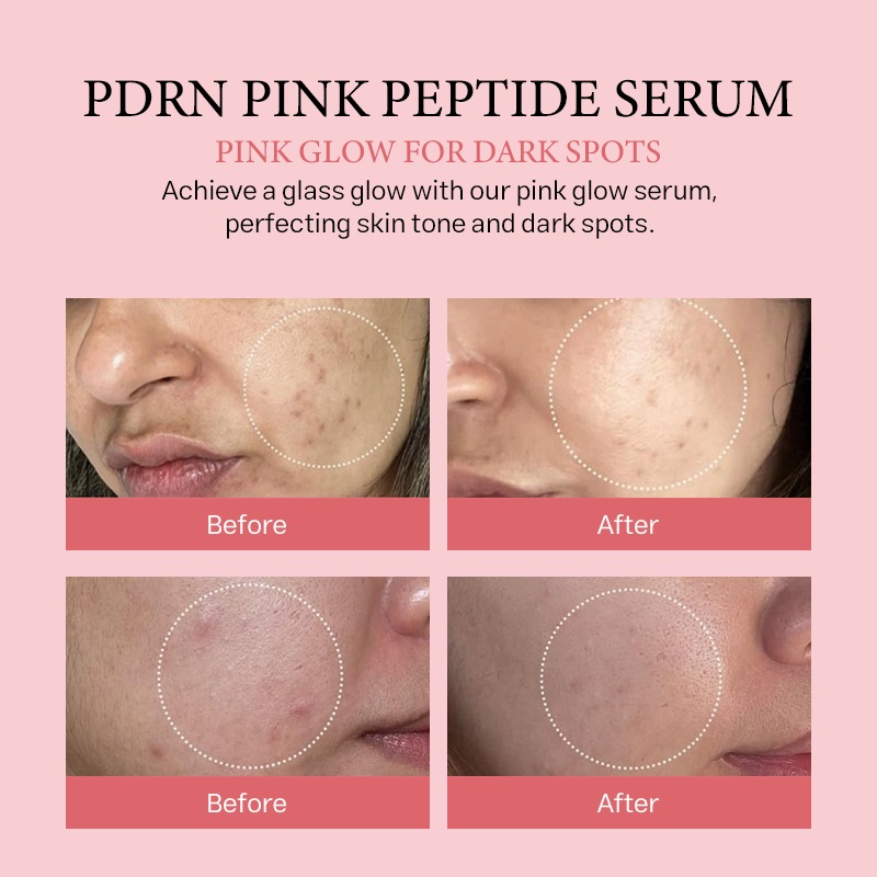 private label salmon dna pdrn pink peptide serum for skin glow hydrating moisturizing firming uneven skin tone korean skincare
